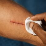 cat spay recovery and cat spay aftercare